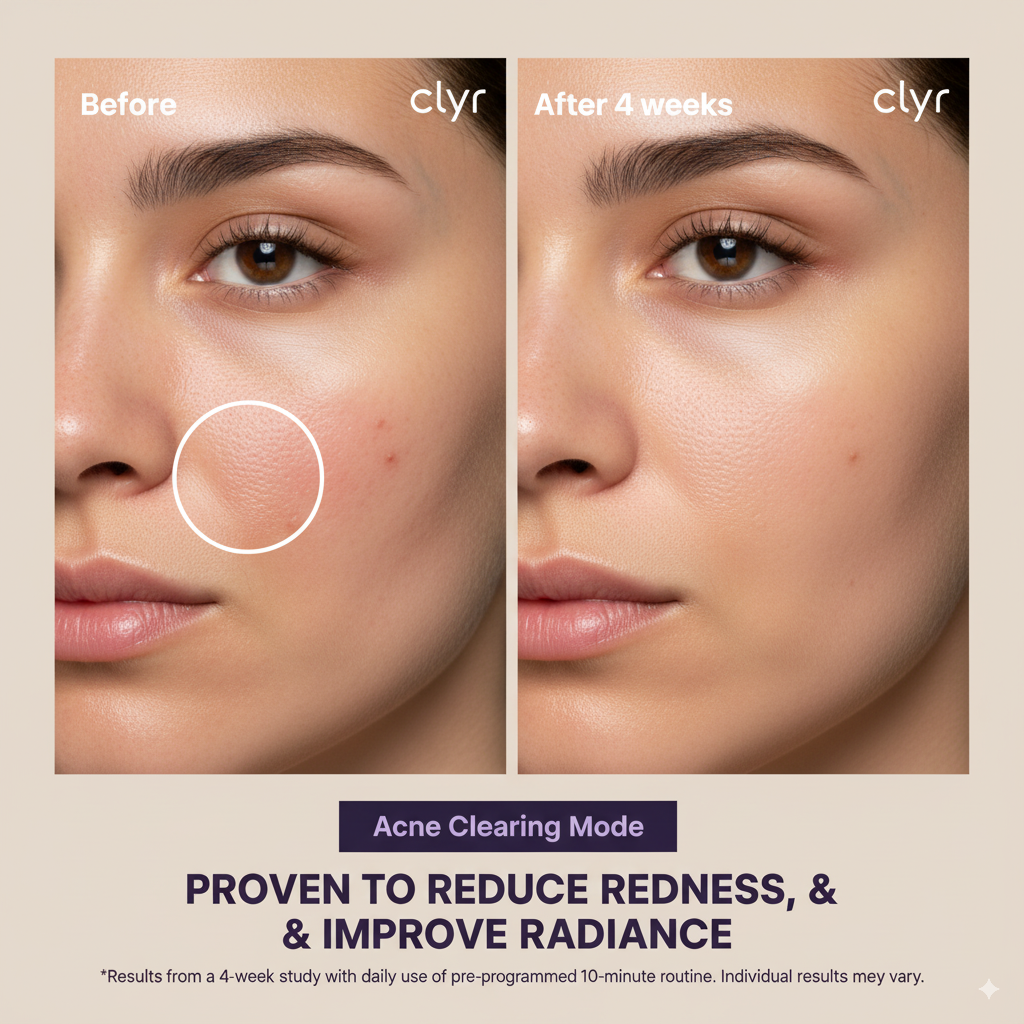 LED Skin Rejuvenation Mask – Collagen Boost & Acne Care